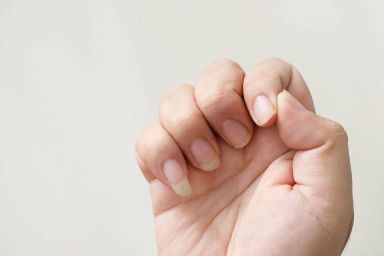 Why Do My Cuticles Itch? Causes and Treatments