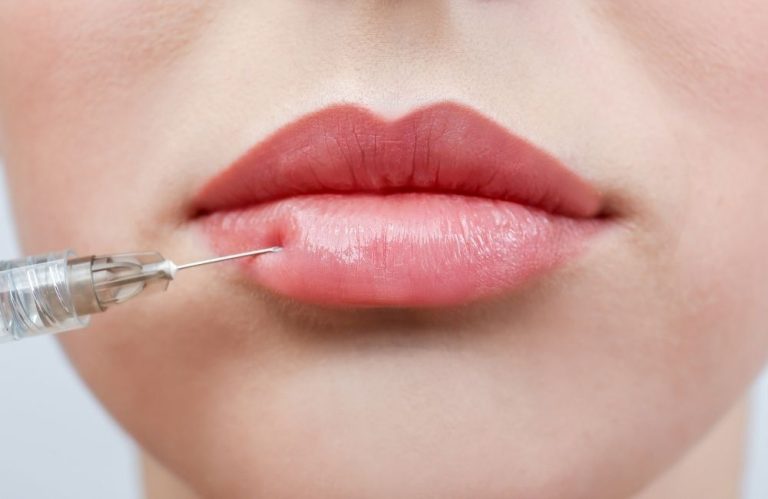 Are Lip Fillers Haram or Halal In Islam?