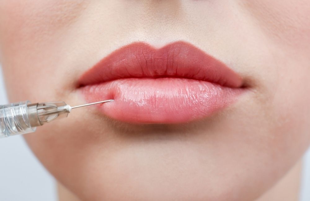 Are Lip Fillers Haram or Halal In Islam? IGXO Cosmetics