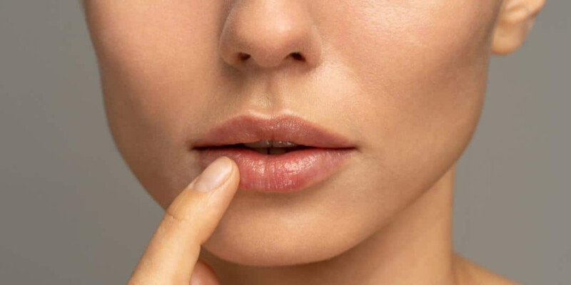 Methods To Alleviate Dry And Peeling Lips