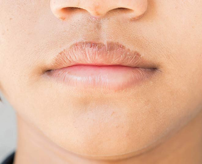 What Causes Dark Lips