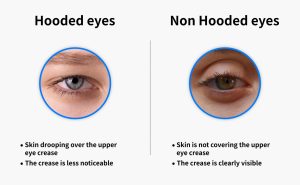 Hooded vs. Non Hooded Eyes - Differences and Similarities