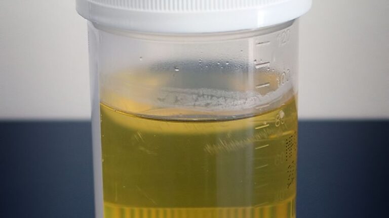 urutan proses pembentukan urine yang benar adalah