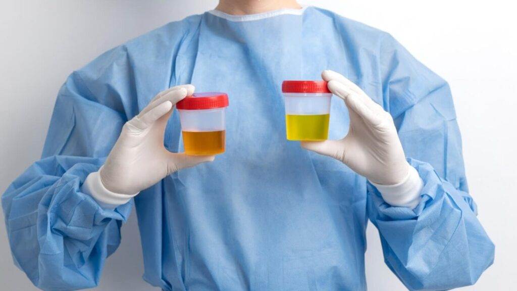 urutan proses pembentukan urine yang benar adalah