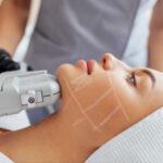 Harnessing The Power Of Ultrasound Energy To Tighten Your Skin